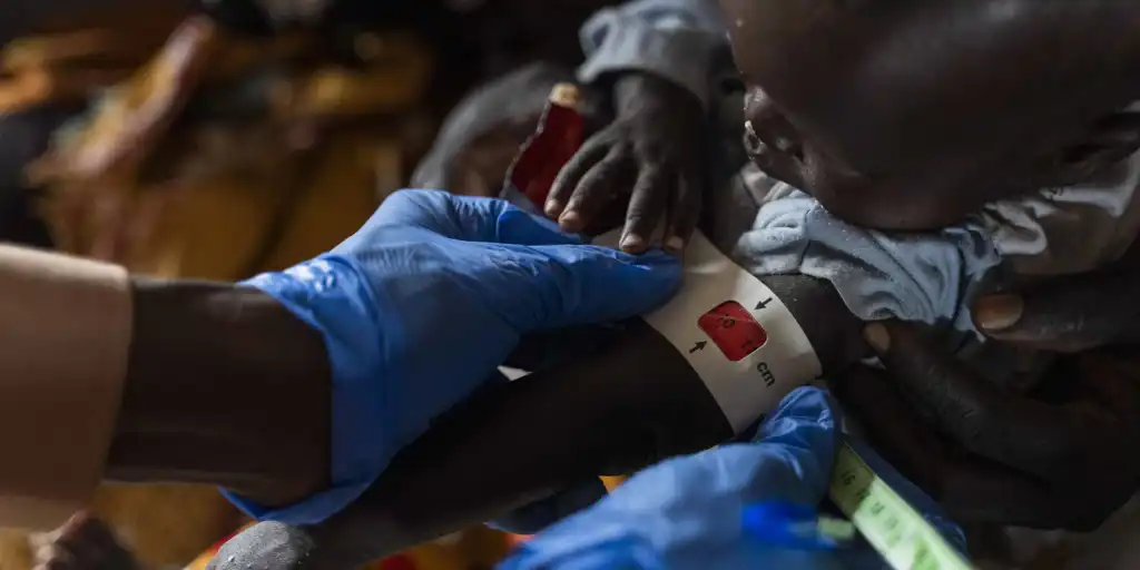Sudan Malnutrition Rising Among Children Refugee Camp Sudan