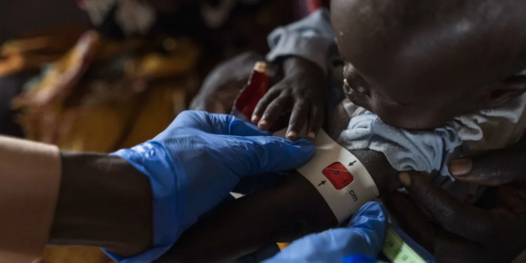 A child is assessed for malnutrition in a displacement camp in White Nile State, Sudan.