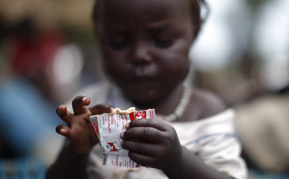 Life-saving therapeutic food